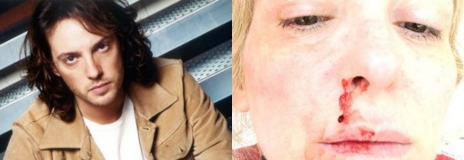 MASSIMO DI CATALDO INDAGATO: PROCURATO ABORTO E MALTRATTAMENTI - FOTO - 22/07/2013